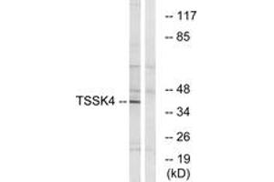 Western blot analysis of extracts from HT-29 cells, using TSSK4 Antibody. (TSSK4 anticorps  (AA 211-260))