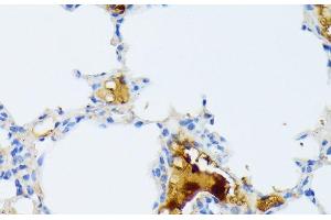 Immunohistochemistry of paraffin-embedded Mouse lung using CTRB1 Polyclonal Antibody at dilution of 1:100 (40x lens). (CTRB1 anticorps)