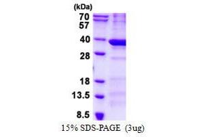 Image no. 1 for BCDIN3 Domain Containing (BCDIN3D) (AA 1-292) protein (His tag) (ABIN1098438)