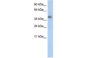 WB Suggested Anti-ZNF620 Antibody Titration: 2. (ZNF620 anticorps  (Middle Region))