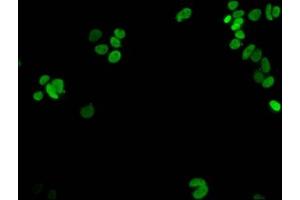 Immunofluorescent analysis of MCF-7 cells using ABIN7139274 at dilution of 1:100 and Alexa Fluor 488-congugated AffiniPure Goat Anti-Rabbit IgG(H+L)