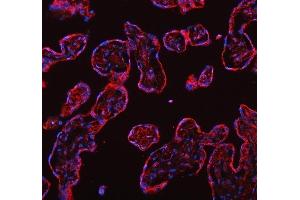 IF analysis of DYNLT1 using anti-DYNLT1 antibody (ABIN5693148).
