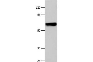 Western Blot analysis of 293T cell using CNGA2 Polyclonal Antibody at dilution of 1:500 (CNGA2 anticorps)
