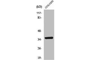 Western Blot analysis of COLO205 cells using AASD-PPT Polyclonal Antibody (AASDHPPT anticorps  (N-Term))