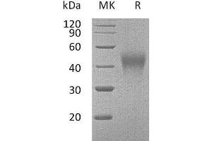 Hepatitis A Virus Cellular Receptor 2 (TIM 3) (AA 20-193) protein (His tag)