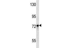 KEAP1 antibody western blot analysis in MDA-MB231 lysate.