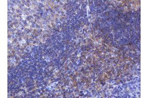 Image no. 1 for anti-Fibronectin Type III Domain Containing 4 (FNDC4) antibody (ABIN1498289)