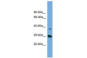 WB Suggested Anti-ATG16L1  Antibody Titration: 0. (ATG16L1 anticorps  (Middle Region))