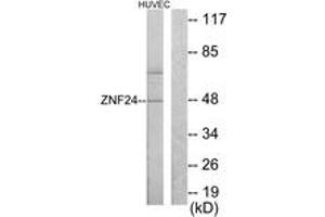 Western Blotting (WB) image for anti-Zinc Finger Protein 24 (ZNF24) (AA 10-59) antibody (ABIN2889405) (ZNF24 anticorps  (AA 10-59))