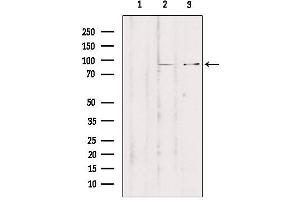Western blot analysis of extracts from various samples, using ZNF148 Antibody.