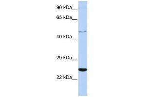 CRLF1 antibody used at 1 ug/ml to detect target protein. (CRLF1 anticorps  (Middle Region))