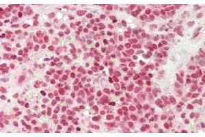 Detection of DNASE1 in Human Spleen Tissue using Monoclonal Antibody to Deoxyribonuclease I (DNASE1)
