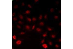 Immunofluorescent analysis of INTS6 staining in Hela cells. (INTS6 anticorps)