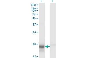 Western Blot analysis of SKP1 expression in transfected 293T cell line by SKP1A monoclonal antibody (M01), clone 1H8. (SKP1 anticorps  (AA 53-160))