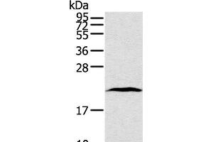 Western Blot analysis of Human lung cancer tissue using TAF10 Polyclonal Antibody at dilution of 1:400