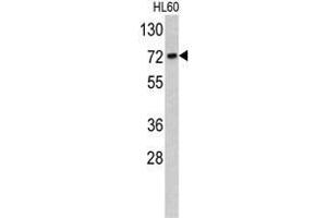 Western blot analysis of TOMM70A antibody (C-term) in HL60 cell line lysates (35ug/lane). (TOM70 anticorps  (C-Term))