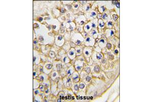 Formalin-fixed and paraffin-embedded human testis tissue reacted with Trpv3 polyclonal antibody  , which was peroxidase-conjugated to the secondary antibody, followed by DAB staining. (TRPV3 anticorps  (C-Term))
