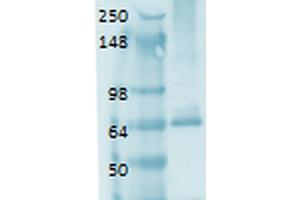 Western Blot analysis of Human thyroid lysate showing detection of Sodium Iodide Symporter protein using Mouse Anti-Sodium Iodide Symporter Monoclonal Antibody, Clone 14F . (SLC5A5 anticorps  (AA 468-643) (PerCP))