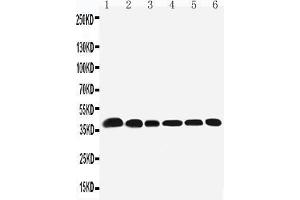 Anti-Nucleophosmin antibody, Western blotting Lane 1: Rat Testis Tissue Lysate Lane 2: Rat Brain Tissue Lysate Lane 3: HELA Cell Lysate Lane 4: U87 Cell Lysate Lane 5: A549 Cell LysateLane6: SMMC Cell Lysate (NPM1 anticorps  (N-Term))