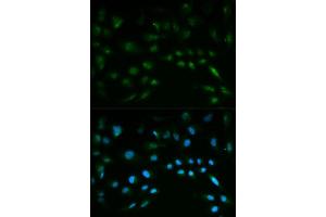 Immunofluorescence analysis of HeLa cell using NFE2L2 antibody.