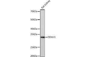 Western blot analysis of extracts of Rat kidney, using DD Rabbit mAb (ABIN7266778) at 1:1000 dilution. (DDAH1 anticorps)