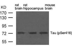 Western blot analysis of extract from rat brain, rat hippocampus and mouse brain using Tau(phospho-Ser416) Antibody. (MAPT anticorps  (pSer416))