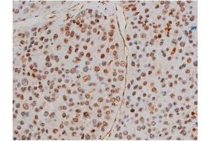 ABIN6267433 at 1/200 staining Human tonsil tissue sections by IHC-P. (Filamin A anticorps  (pSer2152))
