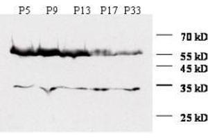 Anti-Zic1 Antibody - Western Blot A similar time course experiment is shown using mouse cerebellum extracts at various time points. (ZIC1 anticorps  (N-Term))