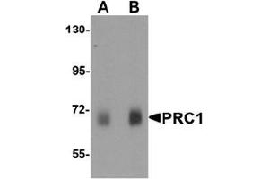 Western blot analysis of PRC1 in human skeletal muscle tissue lysate with Prc1 antibody at (A) 0. (PRC1 anticorps  (Middle Region))