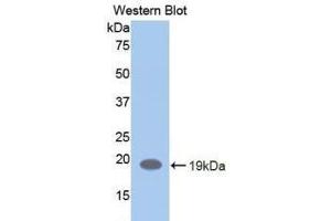 Detection of Recombinant LIFR, Human using Polyclonal Antibody to Leukemia Inhibitory Factor Receptor (LIFR)
