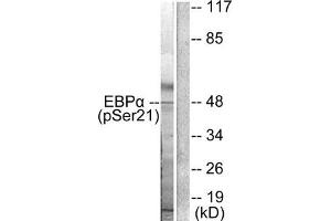 Western blot analysis of extracts from HepG2 cells treated with EGF using C/EBP-α (phospho-Ser21) Antibody.
