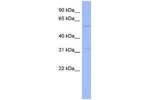 WB Suggested Anti-ZNF266 Antibody Titration:  0.