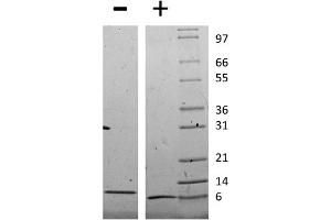 SDS-PAGE of Mouse Monocyte Chemotactic Protein-2 (CCL8) Recombinant Protein SDS-PAGE of Mouse Monocyte Chemotactic Protein-2 (CCL8) Recombinant Protein. (CCL8 Protéine)