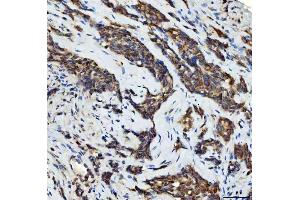 IHC analysis of Aurora A/AURKA using anti-Aurora A/AURKA antibody (ABIN7600751). (Aurora A anticorps  (AA 23-403))