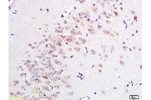 Formalin-fixed and paraffin embedded rat brain tissue labeled with Anti ENKEPHALIN/P-ENK Polyclonal Antibody, Unconjugated (ABIN677633) at 1:200 followed by conjugation to the secondary antibody and DAB staining. (Enkephalin anticorps)