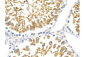 ABIN6257454 and ABIN6275443 at 1/100 staining Rat testis tissue by IHC-P. (RANBP17 anticorps  (N-Term))