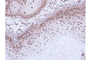 IHC-P Image Immunohistochemical analysis of paraffin-embedded Cal27 xenograft , using DMC1, antibody at 1:500 dilution.