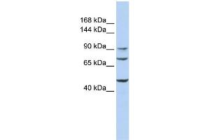 WB Suggested Anti-GALNT5 Antibody Titration:  0. (GALNT5 anticorps  (Middle Region))