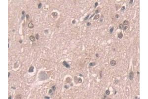 Detection of NOX1 in Human Cerebrum Tissue using Polyclonal Antibody to Nicotinamide Adenine Dinucleotide Phosphate Oxidase 1 (NOX1) (NOX1 anticorps  (AA 235-488))