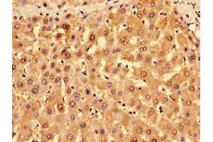 Immunohistochemistry of paraffin-embedded human liver tissue using ABIN7142715 at dilution of 1:100