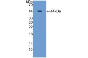 Detection of Recombinant MUC5B, Rat using Polyclonal Antibody to Mucin 5 Subtype B (MUC5B)
