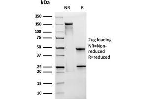 SDS-PAGE Analysis Purified CD28 Mouse Monoclonal Antibody (CB28).