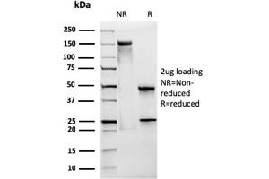 SDS-PAGE Analysis Purified CD28 Mouse Monoclonal Antibody (CB28). (CD28 anticorps)