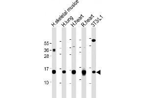 All lanes : Anti-FABP4 Antibody (Y20) at 1:2000-1:8000 dilution Lane 1: Human skeletal muslce lysate Lane 2: Human lung lysate Lane 3: Human heart lysate Lane 4: Rat heart lysate Lane 5: 3T3/L1 whole cell lysate Lysates/proteins at 20 μg per lane. (FABP4 anticorps  (AA 1-30))
