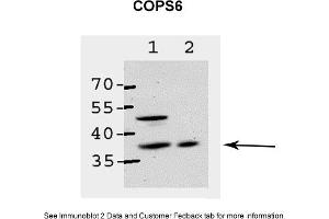 Sample Type: 1. (COPS6 anticorps  (Middle Region))