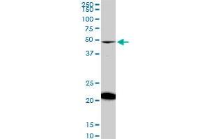 NADK monoclonal antibody (M01), clone 5F4. (NADK anticorps  (AA 1-446))