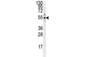 Western blot analysis of PTP1B antibody and Ramos lysate.