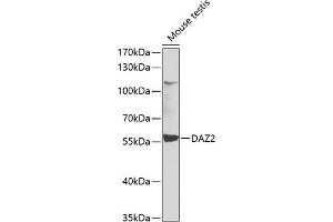 Western blot analysis of extracts of mouse testis, using D antibody (ABIN6127797, ABIN6139413, ABIN6139414 and ABIN6223512) at 1:1000 dilution. (DAZ2 anticorps  (AA 1-200))