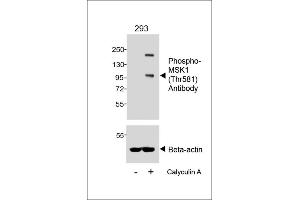 Western blot analysis of lysates from 293 cell line, untreated or treated with Calyculin A, 100nM, 30 min, using Phospho-MSK1 (Thr581) Antibody (upper) or Beta-actin (lower). (MSK1 anticorps  (pThr581))