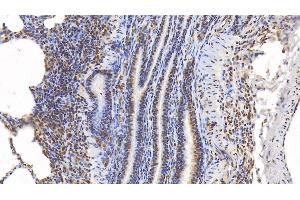 Detection of ERK2 in Porcine Lung Tissue using Monoclonal Antibody to Extracellular Signal Regulated Kinase 2 (ERK2) (ERK2 anticorps  (AA 25-360))
